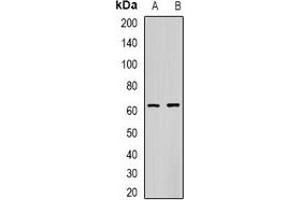 Image no. 2 for anti-Carboxylesterase 1 (CES1) antibody (ABIN2966516)