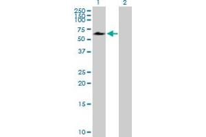 Image no. 1 for anti-Adrenocortical Dysplasia Homolog (ACD) (AA 1-544) antibody (ABIN528770)