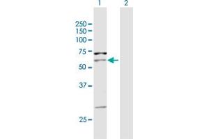 Western Blot analysis of PIP5K1A expression in transfected 293T cell line by PIP5K1A MaxPab polyclonal antibody.