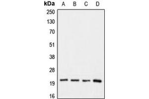 Western blot analysis of Claudin 1 expression in HeLa (A), HepG2 (B), mouse kideney (C), rat kidney (D) whole cell lysates.