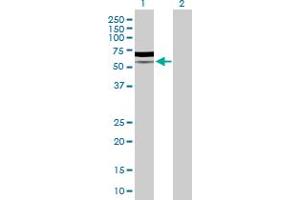 Image no. 1 for anti-Phosphoinositide-3-Kinase, Regulatory Subunit 5 (PIK3R5) (AA 1-494) antibody (ABIN525232)