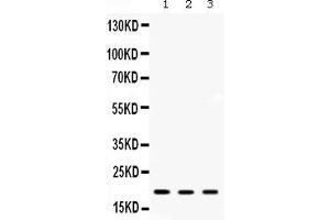 Image no. 1 for anti-ADP-Ribosylation Factor 6 (ARF6) (AA 2-175) antibody (ABIN4886473)