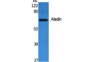 Image no. 1 for anti-Achalasia, Adrenocortical Insufficiency, Alacrimia (AAAS) (C-Term) antibody (ABIN3187610)