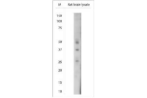 Image no. 1 for anti-Mitochondrially Encoded ATP Synthase 6 (MT-ATP6) (AA 10-50) antibody (ABIN1841895)