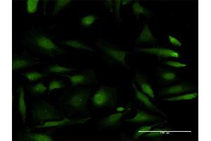 Immunofluorescence of purified MaxPab antibody to RPS6KB2 on HeLa cell.