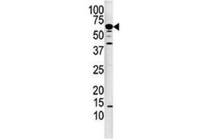 Image no. 3 for anti-Calcineurin (CAN) (AA 21-51) antibody (ABIN3028953)