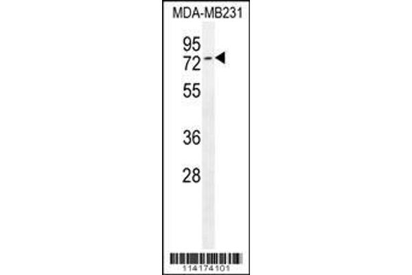anti-TCDD-Inducible Poly(ADP-Ribose) Polymerase (Tiparp) (AA 263-292), (C-Term) antibody