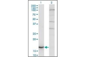 Image no. 3 for anti-Cytochrome b5 (CYTB5) (AA 1-135) antibody (ABIN951799)