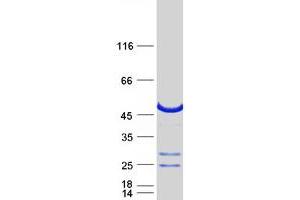 Image no. 1 for RAB3A Interacting Protein (Rabin3)-Like 1 (RAB3IL1) protein (Myc-DYKDDDDK Tag) (ABIN2730352)