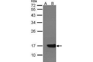 Image no. 1 for anti-Cytochrome b5 (CYTB5) (Center) antibody (ABIN2855226)