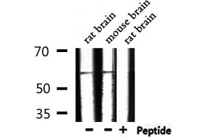 Image no. 4 for anti-Proto-oncogene tyrosine-protein kinase Src (Src) (pTyr530) antibody (ABIN6256758)