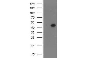 Image no. 1 for anti-SET Domain Containing (Lysine Methyltransferase) 7 (SETD7) antibody (ABIN1500903)