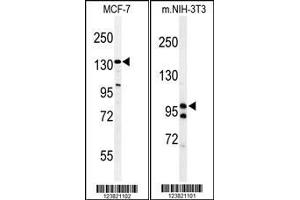 Image no. 1 for anti-TAF2 RNA Polymerase II, TATA Box Binding Protein (TBP)-Associated Factor, 150kDa (TAF2) (AA 1152-1180), (C-Term) antibody (ABIN653923)