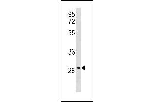 anti-Leucine Rich Repeat Containing 61 (LRRC61) (AA 111-139) antibody