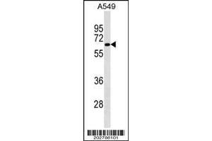 Image no. 2 for anti-Podocalyxin-Like (PODXL) (AA 410-439), (C-Term) antibody (ABIN1540003)