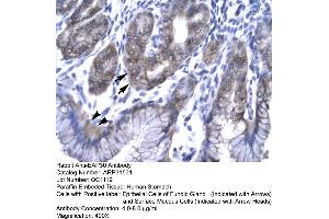 Image no. 2 for anti-Vacuolar-sorting Protein SNF8 (SNF8) (N-Term) antibody (ABIN2777341)