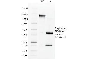 Image no. 1 for anti-Angiotensin I Converting Enzyme (Peptidyl-Dipeptidase A) 1 (ACE) antibody (ABIN6939231)