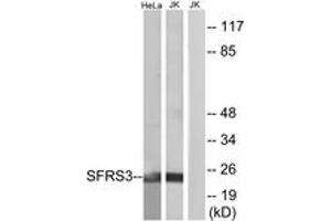 Image no. 1 for anti-serine/arginine-Rich Splicing Factor 3 (SRSF3) (AA 111-160) antibody (ABIN1533812)