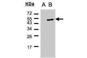 WB Image Western Blot analysis of PSCD1 expression in transfected 293T cell line by PSCD1 polyclonal antibody.