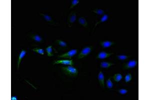 Immunofluorescent analysis of Hela cells using ABIN7143395 at dilution of 1:100 and Alexa Fluor 488-congugated AffiniPure Goat Anti-Rabbit IgG(H+L)