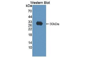 Image no. 1 for anti-ATP-Binding Cassette, Sub-Family C (CFTR/MRP), Member 10 (ABCC10) (AA 1246-1492) antibody (ABIN1866475)