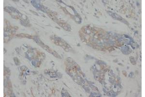 Image no. 1 for anti-Tubulin, alpha 1a (Tuba1a) antibody (ABIN1105303)