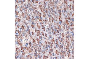 Immunohistochemistry of paraffin-embedded human liver using TIMM50 Rabbit mAb (ABIN1513120, ABIN3022092, ABIN3022093 and ABIN7101443) at dilution of 1:100 (40x lens).