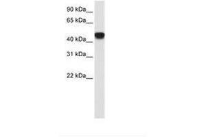 Image no. 2 for anti-Small Nuclear RNA Activating Complex, Polypeptide 1, 43kDa (SNAPC1) (C-Term) antibody (ABIN202353)