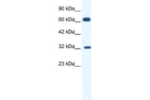Image no. 1 for anti-Potassium Intermediate/small Conductance Calcium-Activated Channel, Subfamily N, Member 1 (KCNN1) (C-Term) antibody (ABIN2776145)