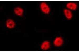 Image no. 1 for anti-Zinc Finger and SCAN Domain Containing 25 (ZSCAN25) (Internal Region) antibody (ABIN6256867)