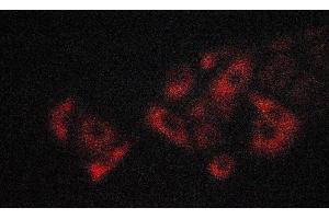Image no. 2 for anti-Tumor Necrosis Factor Receptor Superfamily, Member 1B (TNFRSF1B) (C-Term) antibody (ABIN6256994)