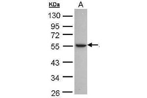 Image no. 1 for anti-Alcohol Dehydrogenase 1C (Class I), gamma Polypeptide (ADH1C) (Center) antibody (ABIN2855026)