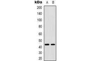 Image no. 2 for anti-T-Box 1 (TBX1) (C-Term) antibody (ABIN2801350)