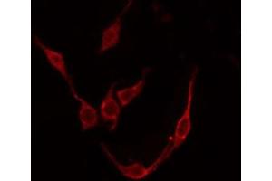 Image no. 1 for anti-Tachykinin Receptor 3 (TACR3) (C-Term) antibody (ABIN6257538)