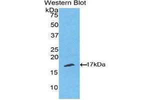 Image no. 1 for anti-RELT Tumor Necrosis Factor Receptor (RELT) (AA 222-363) antibody (ABIN1860801)