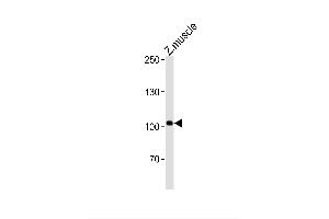 Image no. 1 for anti-HEG Homolog 1 (HEG1) (AA 691-717), (C-Term) antibody (ABIN1881407)