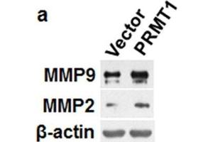 Image no. 8 for anti-Matrix Metalloproteinase 2 (MMP2) (Center) antibody (ABIN2855854)
