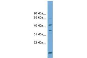Image no. 1 for anti-Apolipoprotein L, 5 (APOL5) (AA 345-394) antibody (ABIN6745507)