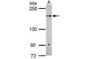 Image no. 1 for anti-Glutamate Receptor, Ionotropic, N-Methyl D-Aspartate 2a (GRIN2A) (N-Term) antibody (ABIN2855656)