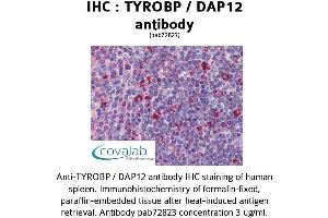 Image no. 1 for anti-TYRO Protein tyrosine Kinase Binding Protein (TYROBP) (Internal Region) antibody (ABIN1740506)