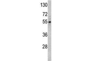 Image no. 3 for anti-Fascin (FSCN1) (AA 322-350) antibody (ABIN3028650)