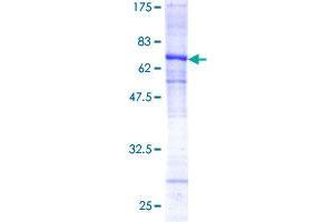 Image no. 1 for Cathepsin L1 (CTSL1) (AA 18-333) protein (GST tag) (ABIN1350727)