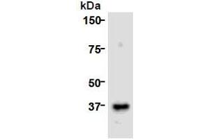Image no. 3 for anti-Cell Division Cycle Associated 8 (CDCA8) (AA 1-280), (N-Term) antibody (ABIN1449290)