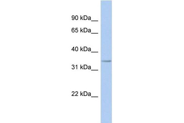 anti-Fat Storage-Inducing Transmembrane Protein 1 (FITM1) (Middle Region) antibody