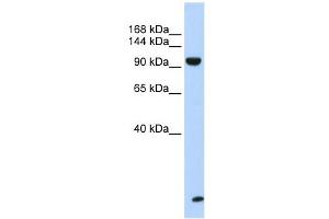 Image no. 1 for anti-Trinucleotide Repeat Containing 6B (TNRC6B) (N-Term) antibody (ABIN633454)