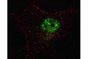 Fluorescent confocal image of SY5Y cells stained with PDX1 antibody.