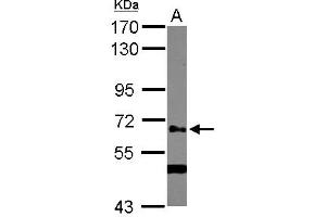 Image no. 1 for anti-UDP-N-Acetyl-alpha-D-Galactosamine:polypeptide N-Acetylgalactosaminyltransferase 14 (GalNAc-T14) (GALNT14) (AA 1-189) antibody (ABIN1498369)