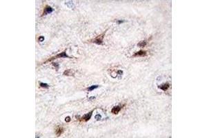 Image no. 2 for anti-Nuclear Receptor Subfamily 4, Group A, Member 2 (NR4A2) (AA 13-42) antibody (ABIN3032065)