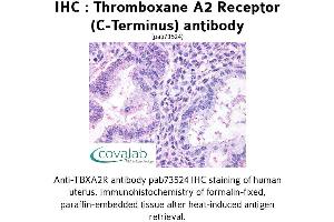 Image no. 1 for anti-Thromboxane A2 Receptor (TBXA2R) (C-Term) antibody (ABIN1740054)