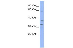 Image no. 1 for anti-Kelch Repeat and BTB (POZ) Domain Containing 5 (KBTBD5) (Middle Region) antibody (ABIN2775940)